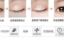 双眼皮手术的后遗症，风险与预防