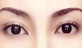 双眼皮手术后遗症，全面解析与视频资源汇总
