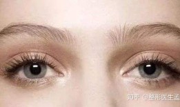 双眼皮手术的后遗症，风险与预防