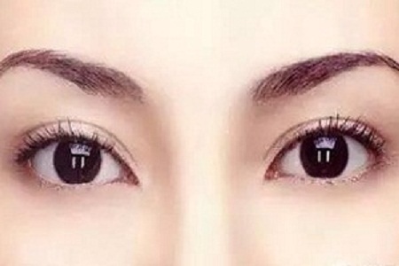 双眼皮手术后遗症，全面解析与视频资源汇总
