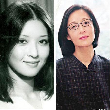 双眼皮手术后的效果，美丽蜕变与恢复过程