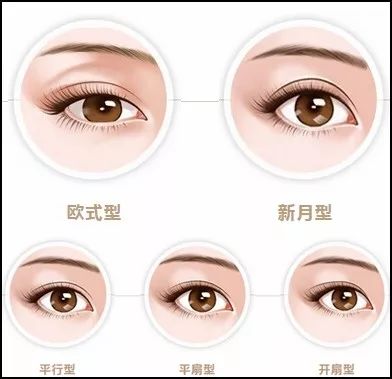 双眼皮手术后的潜在后遗症及应对策略