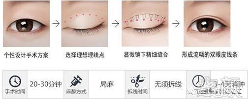 双眼皮手术的后遗症，风险与预防