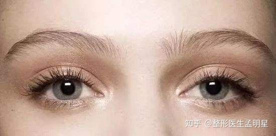 双眼皮手术的后遗症，风险与预防