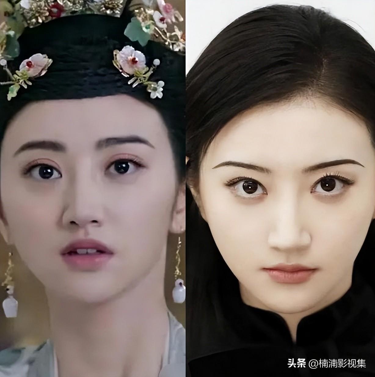双眼皮手术，了解可能的后遗症及预防措施